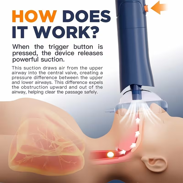 Heimlich Anti-Choking Device